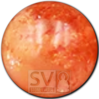 8mm natural Sunstone bead, known for its uplifting properties, promoting positivity, leadership, and joy.
